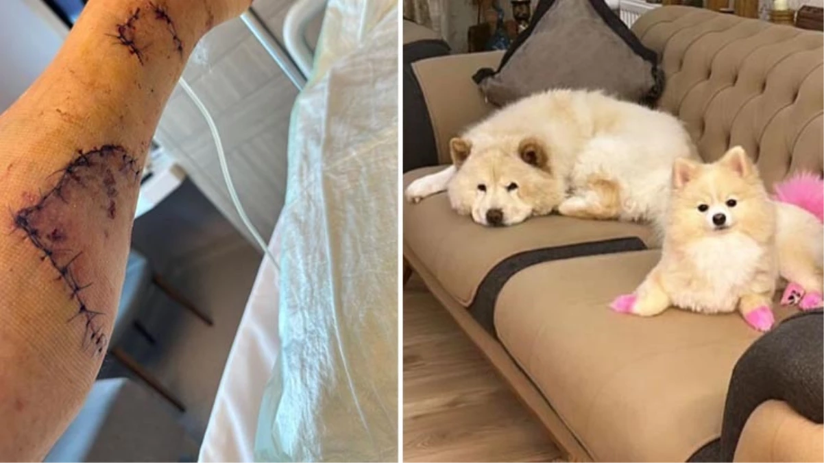 Çin Aslanı, evdeki diğer köpekten kıskandığı sahibinin bacağını parçaladı