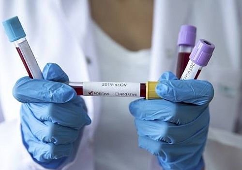  11 Mart tarihinden beri Çıldır´da ilk defa koronavirüs tespit edildi 