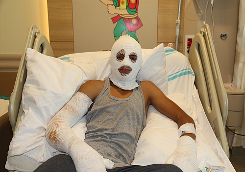 Erzurum'da çakmak gazı tüpü elinde patlayan çocuğun tedavisi sürüyor