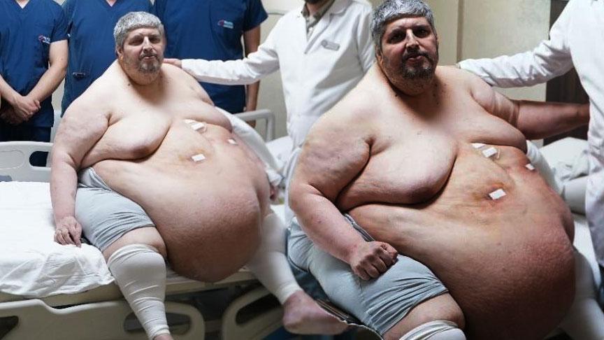 310 kiloya ulaştı! “Ölmek için dua ettim” dedi, yıllar sonra ilk adım