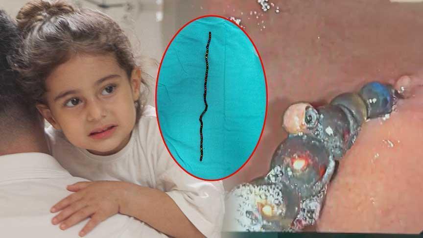 7 ay karnında taşıdı! 3 yaşındaki Berfin doktorları şoke etti! 'Bu oyuncak değil, ölüm tuzağıymış'