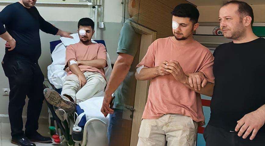 Ahşaptan fırlayan çivi gözüne saplandı: Görme yetisini kaybetti