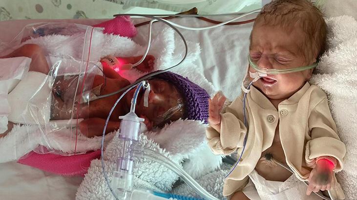 Ardahan Haberi: Aren öldü, ikizi Arden'den 130 gün sonra haber geldi