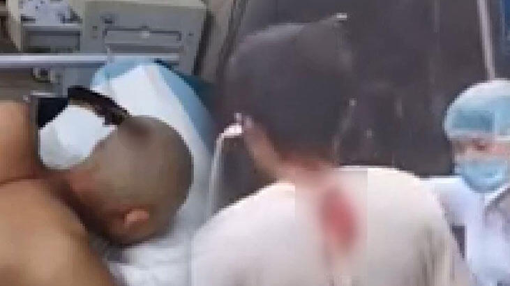 Çin'de kafasına saplı bıçakla sergilediği sakin tavırlar görenleri şaşırttı