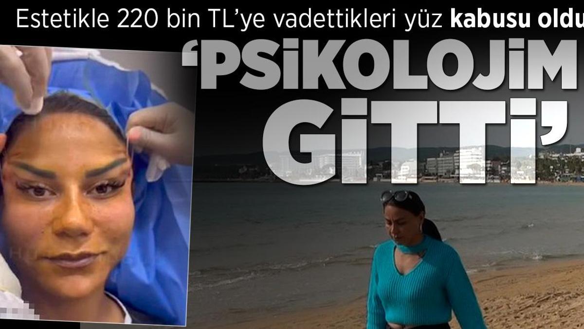 Estetik pişmanlığı! 220 bin TL'ye vadettikleri yüz kabusu oldu