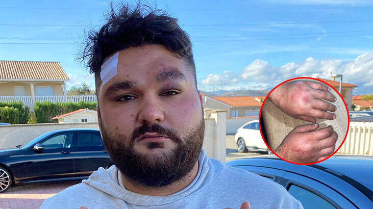 Fransa’da Ermeni protestocuların yaraladığı Türk genç: Bayrağı yakmasınlar diye gittik