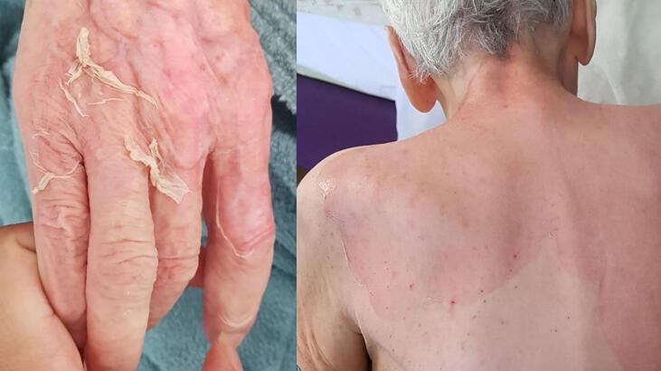 Huzurevinde 'banyo' sonrası hayatını kaybetmişti... Yeni detaylar ortaya çıktı