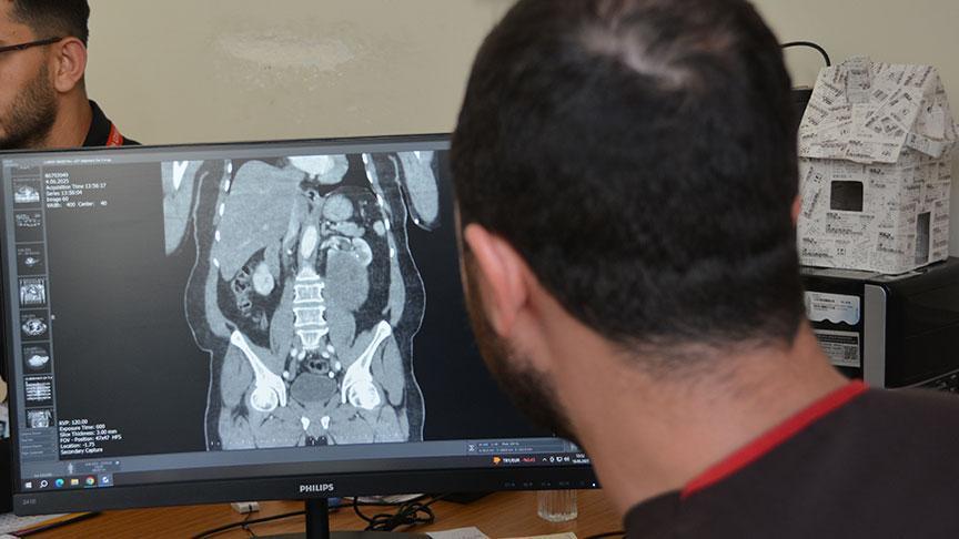 Karın şişliği için hastaneye gitti, hayatını şokunu yaşadı! 'Neredeyse tamamını kaplamıştı'