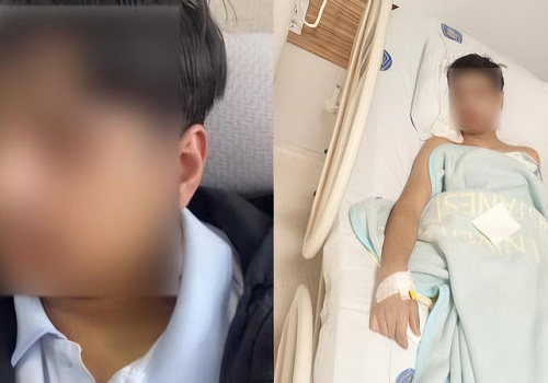 Antalya’da Lisede Teneffüs Kavgası: 9. Sınıf Öğrencisinin Çenesi Kırıldı