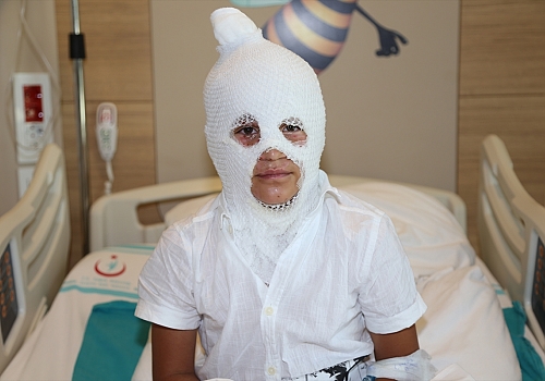 Arkadaşının yaktığı kolonyayı söndürürken yanan çocuk Erzurum'da tedaviye alındı