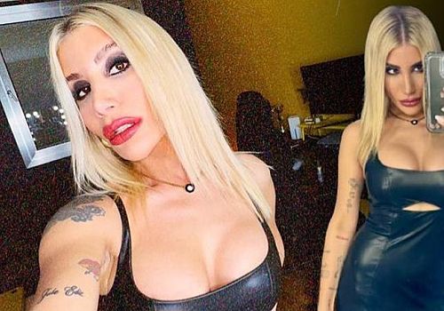 İrem Derici, sağlık problemleriyle uğraşıyor
