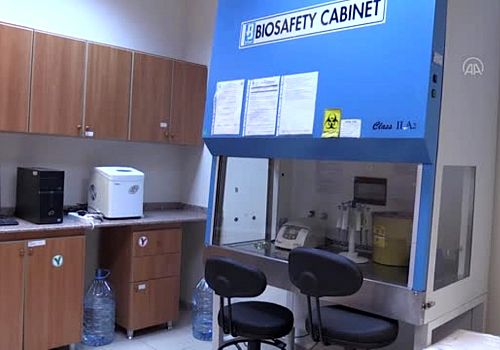 Kars Kafkas Üniversitesin de Kovid-19 tanı testleri yapılmaya başlandı