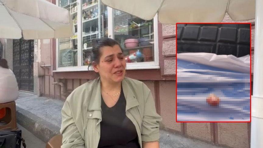 Yer: Bursa! İlkokulda dehşet: Parmağı kopan öğrenci derste kanlar içinde bekletildi