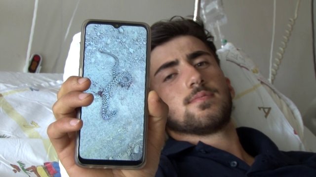 Zehirli yılanın ısırdığı genç Erzurum'da hayata tutundu